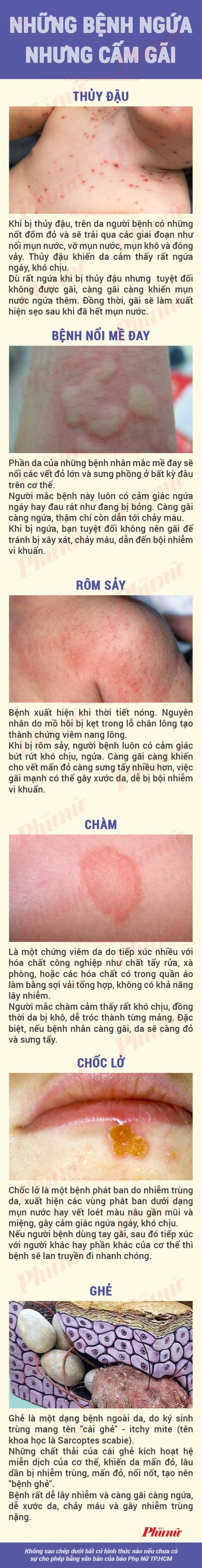 Bệnh gì làm ngứa 'điên cuồng' nhưng tuyệt đối không được gãi