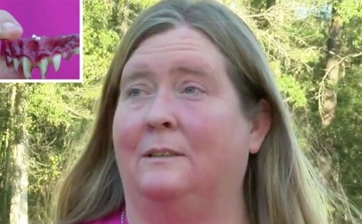 Hóa trang Halloween, người phụ nữ bị kẹt răng giả trong miệng 2 ngày