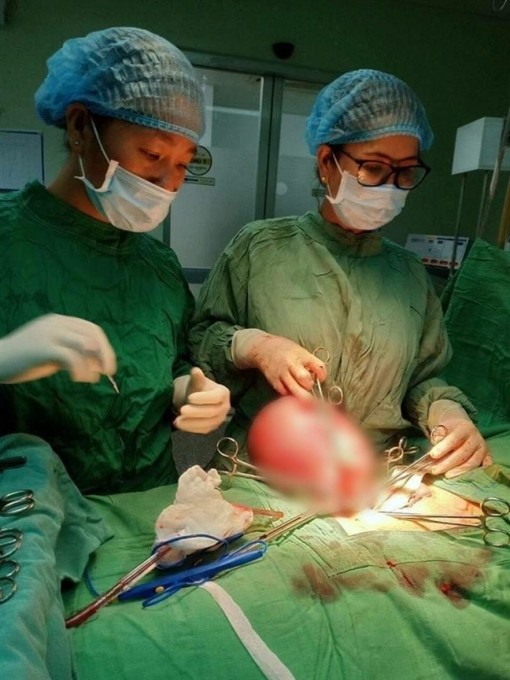 Người mẹ 47 tuổi 2 năm ròng mang trong người khối u 4,7kg vì dành tiền cho con ăn học