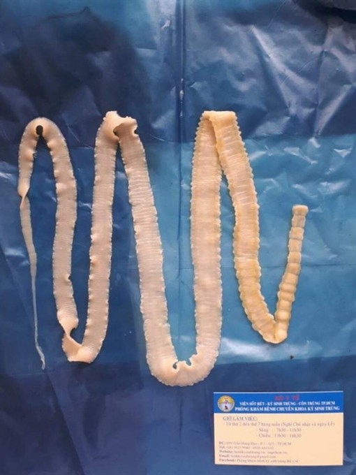 Phát hiện 108 người ở Bình Phước mắc bệnh heo gạo