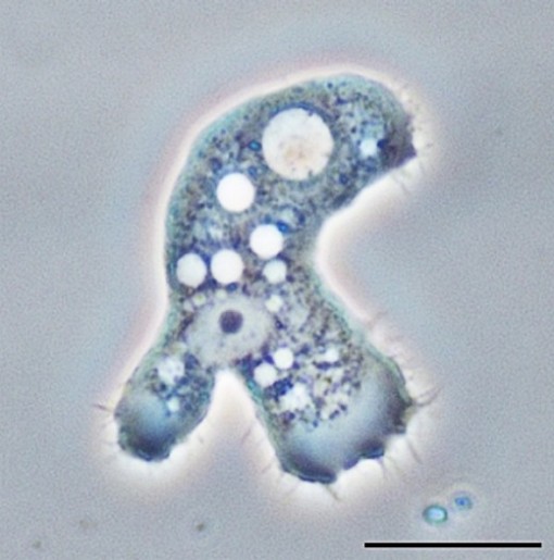 Loài sinh vật thường có trong hồ bơi khiến một phụ nữ bị mù