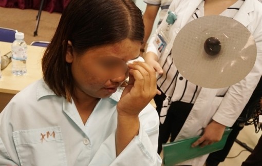 Đang đứng trong nhà, người phụ nữ suýt chết vì đạn lạc vào mắt