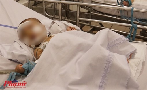 Mẹ tử vong, con phỏng nặng vì cắm điện quạt máy