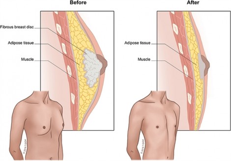 Nam giới quá khổ vòng một do dùng mỹ phẩm của nữ