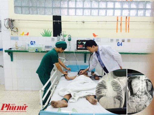 Bé trai ở Đồng Nai nhập viện vì đám bạn chặn đầu bơm hơi vào hậu môn