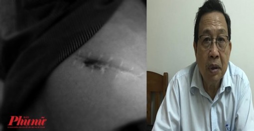 Kẽ hở nào của 'luật hiến tạng' để kẻ xấu lợi dụng mua bán?