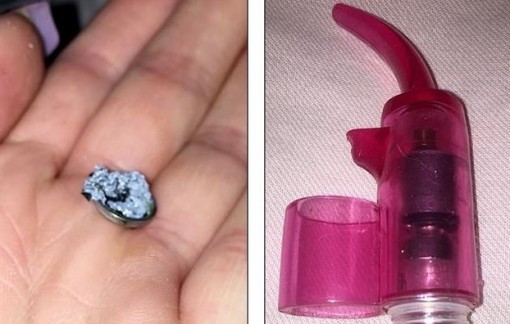 Cô gái suýt bị mù vì đồ chơi tình dục phát nổ