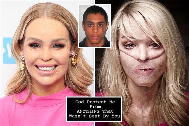 Nhan vat sinh nam Hoi noi bat - Katie Piper: Tai sinh tu tan cung noi dau