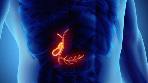 Những trường hợp nào cần mổ bỏ túi mật?