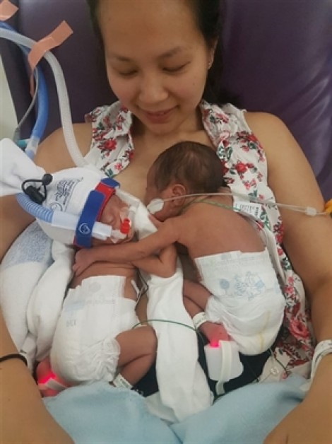 Sinh non ở tuần 29, cặp song sinh lần đầu gặp nhau trong vòng tay mẹ