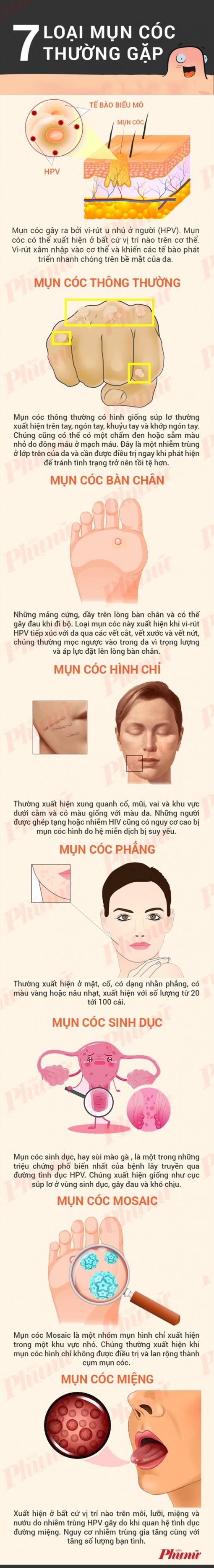 7 loại mụn cóc thường gặp
