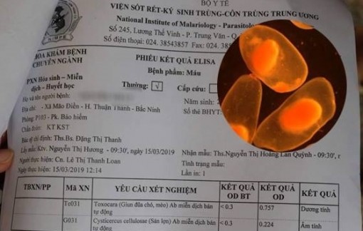 Ngoài sán dải heo, cần cảnh giác với sán dải bò và sán dải cá