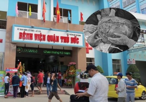 Cụ bà 78 tuổi mang khối u buồng trứng nặng hơn 30 ký