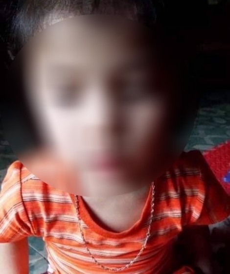 Xác minh vụ bé gái 5 tuổi bị cô giáo bôi chất bẩn vào vùng kín