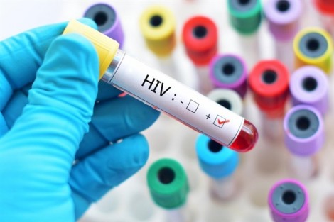 Điều trị dự phòng trước phơi nhiễm nhằm giảm số ca HIV