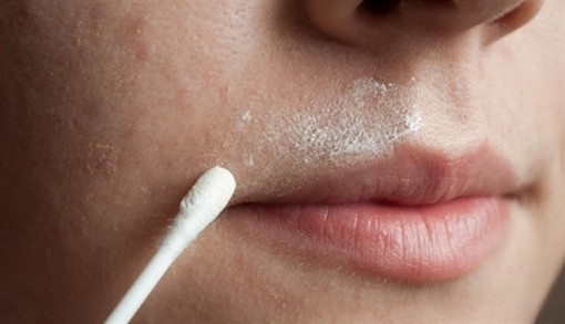 Lỡ làng vì hàm ria chơi khăm