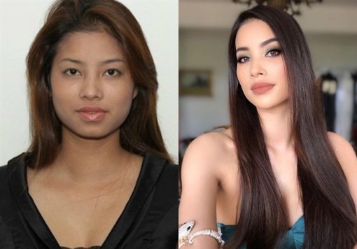 Loạt sao Việt 'lên hương' nhan sắc nhờ 'dao kéo'