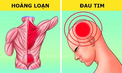 6 vị trí đau trên cơ thể mà ta hay nhầm lẫn với các bệnh khác