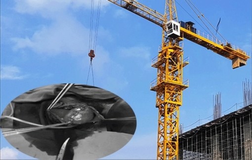 Nam thanh niên bị cần cẩu móc rách… 'của quý'