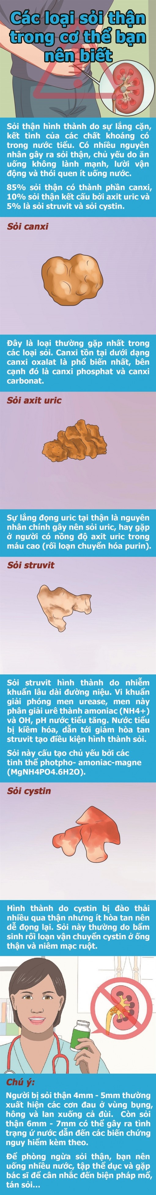 Các loại sỏi thận trong cơ thể bạn nên biết