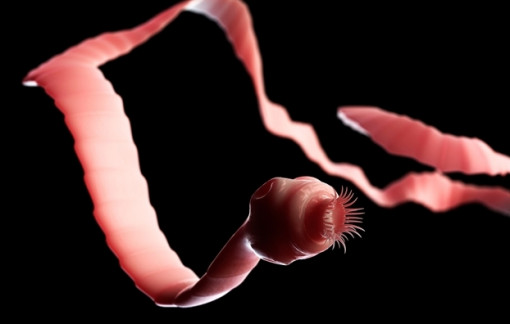 Tưởng đau bao tử ai ngờ nhiễm sán dải heo