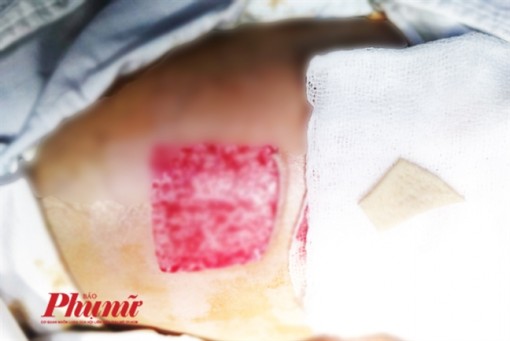 Vì sao TP.HCM đề xuất bác sĩ người nước ngoài phải biết tiếng Việt khi khám bệnh cho người Việt?