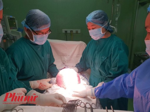 Tưởng mập bụng sau mãn kinh nào ngờ mang khối u 4,5kg