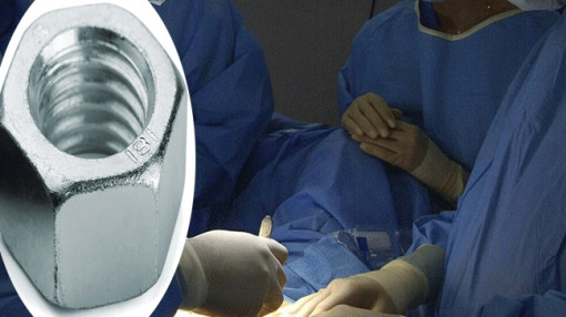 Bác sĩ phải dùng máy cắt kim loại để giải cứu 'cậu nhỏ' lọt vào bu lông