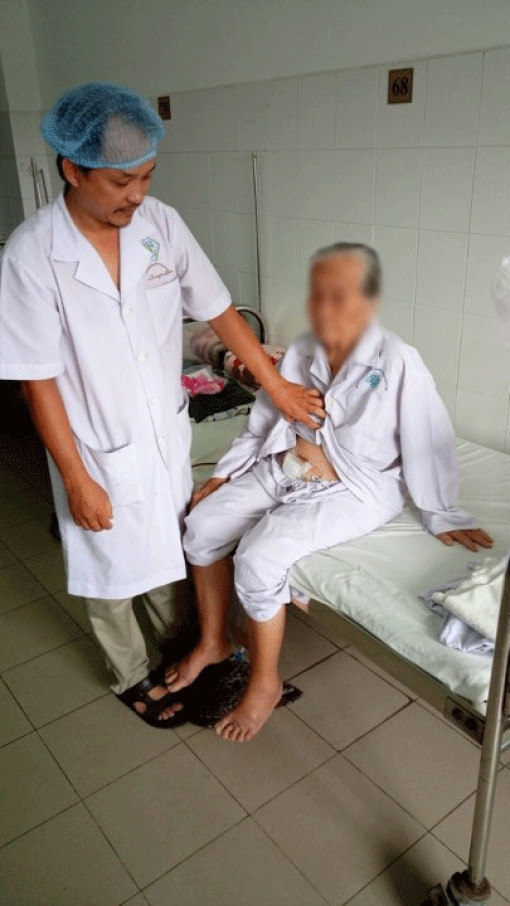 Sỏi bàng quang to hơn trứng ngỗng nằm trong cơ thể suốt 10 năm