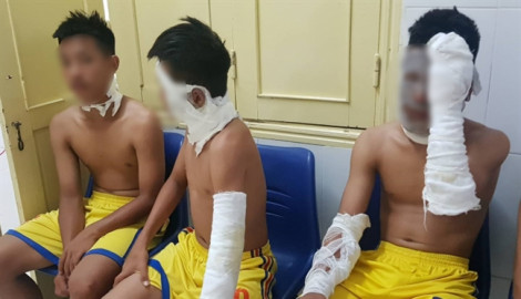 Bóng bay phát nổ, 3 cầu thủ Sông Lam Nghệ An bị bỏng nặng