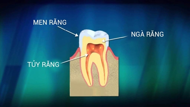 Phuong phap moi giup het sau rang trong 2 ngay?