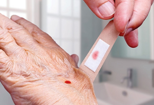 Uống trà chứa băng cá nhân dính máu có nhiễm HIV?