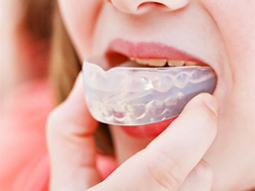 Hỏng 'góc con người' vì tự ý niềng chỉnh răng tại nhà