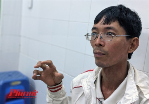 Biến dạng cơ thể vì tin corticoid chữa dứt điểm bệnh vảy nến