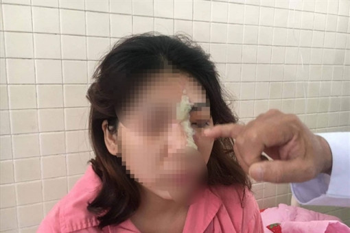 2 phụ nữ bị mù sau khi tiêm filler làm đẹp