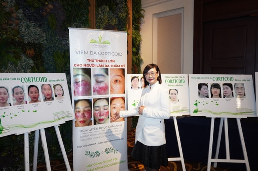 Lạm dụng corticoid để làm đẹp, nhiều người bị biến chứng viêm da đáng sợ