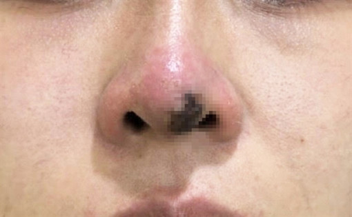 Nghiện dao kéo, rủ luôn chuyên gia trị tâm lý đi làm đẹp