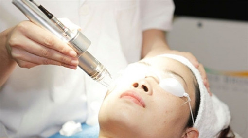 Nám da do rối loạn nội tiết tố có dễ trị?
