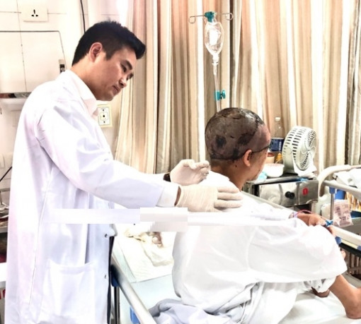 Tóc quấn vào máy tạo ren sắt, một phụ nữ bị lột da đầu và mặt