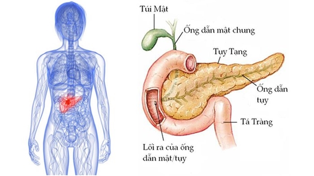 Tim thay loai thuoc quen thuoc co the thu nho 'khoi u chet nguoi' cho benh nhan ung thu tuyen tuy