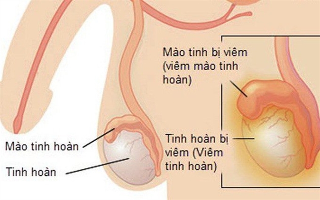 Cay ghep thanh cong tinh hoan cua mot nguoi anh sinh doi cho em trai