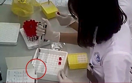 Giam doc Benh vien Xanh Pon: Cat doi que xet nghiem HIV, viem gan B la de... thu nghiem