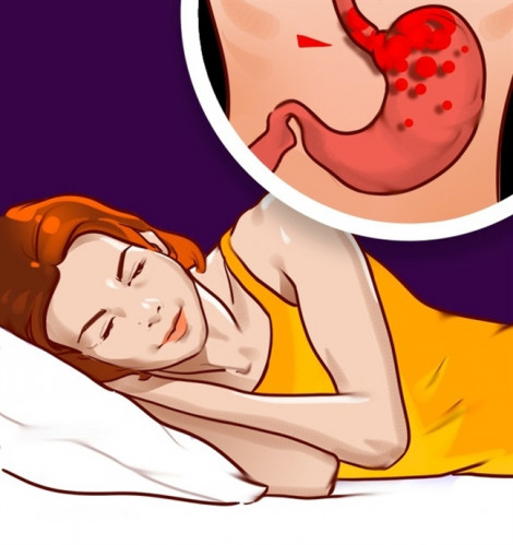 Mắc bệnh gì cần hạn chế nằm nghiêng khi ngủ?