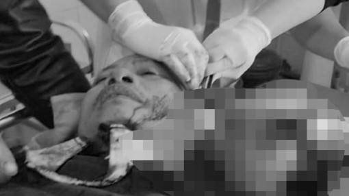 Đi tìm con, công an xã bị nhóm thanh niên chém trọng thương