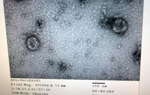 Việt Nam nuôi cấy và phân lập thành công virus corona mới