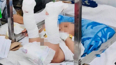 Vụ em bé 4 tháng tuổi nghi bị đánh đến xuất huyết não, gãy chân: Tạm giam người cha tàn độc