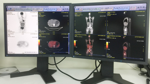 Bệnh viện Ung Bướu TPHCM đưa máy PET/CT hiện đại nhất Việt Nam vào sử dụng