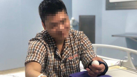 Lần đầu tiên bệnh viện Việt Nam ghép tay từ người cho còn sống