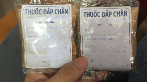 Sợ bị mổ, người đàn ông phải trải qua nhiều ca phẫu thuật để cứu chân do tự đắp thuốc