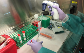 Mỹ thiếu bộ dụng cụ, ảnh hưởng đến tốc độ xét nghiệm SARS-CoV-2